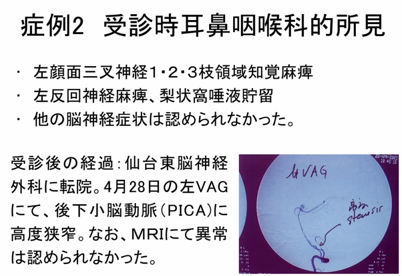 図06