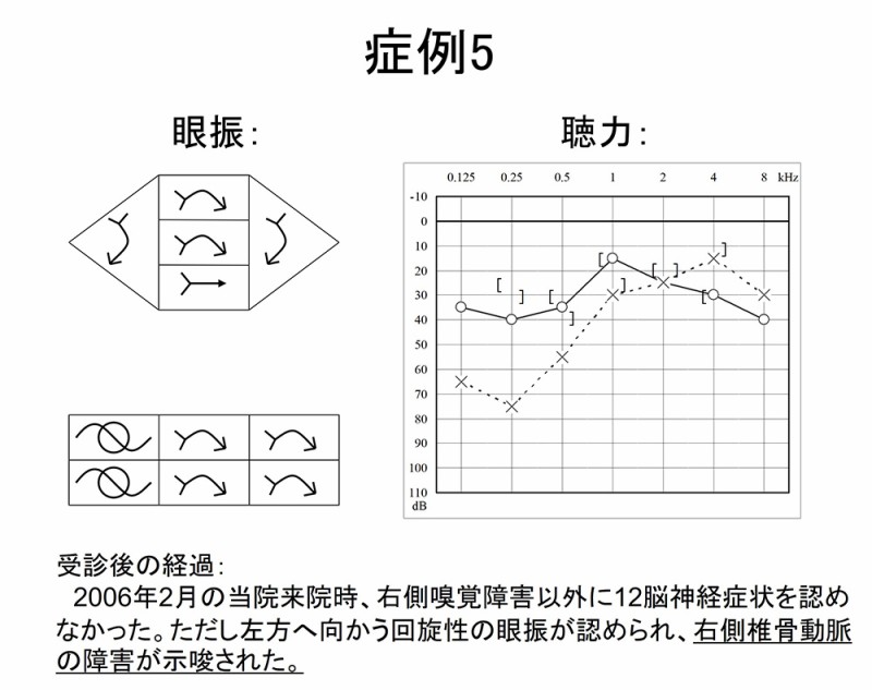 図14