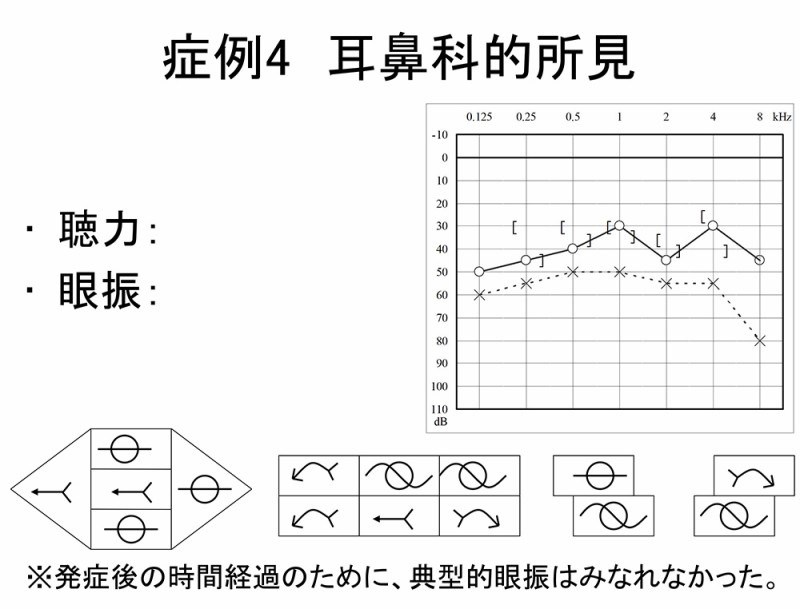 図11