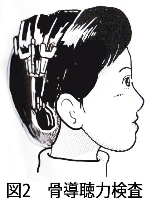 図02 骨導