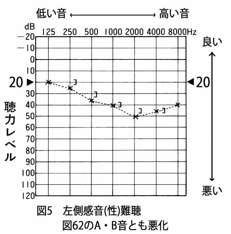 図05 左耳