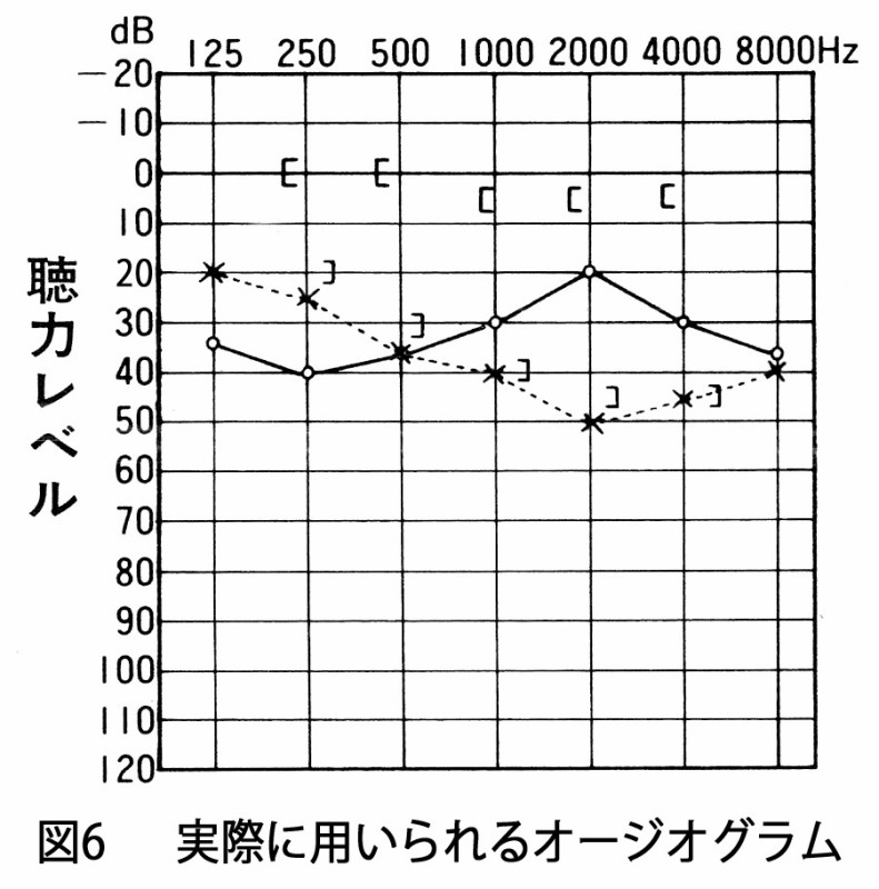 図06 実際のオージオグラムのコピー