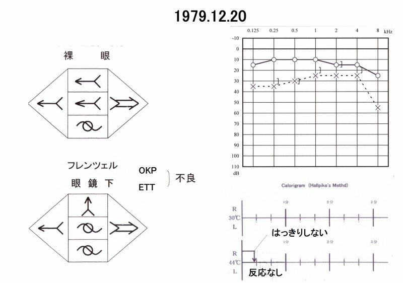 図06