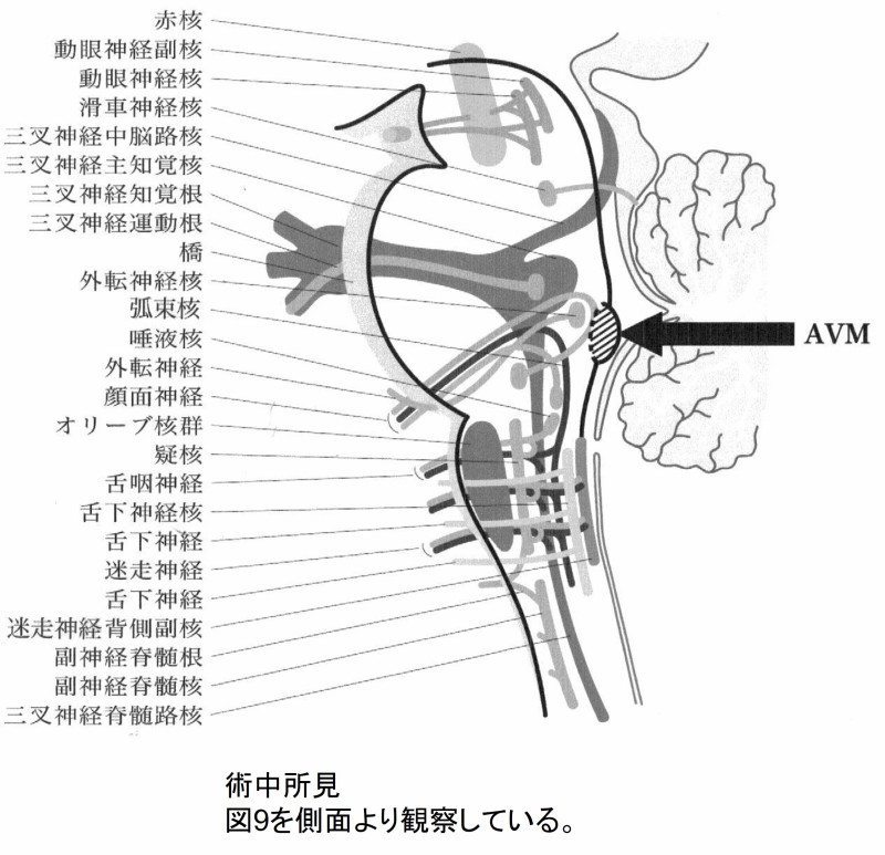 図11