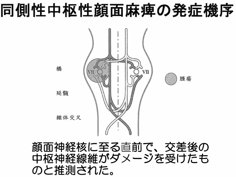 図13