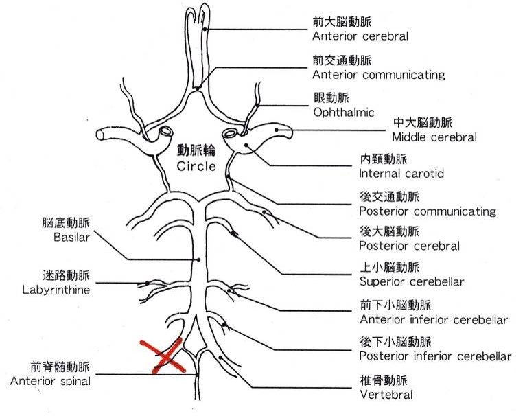 図05 図4の模式図